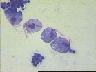 whitefish parazita pinworm férgek az emberek kezelésében