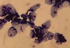 citrosept parazita kezelés gyertyák férgek címről