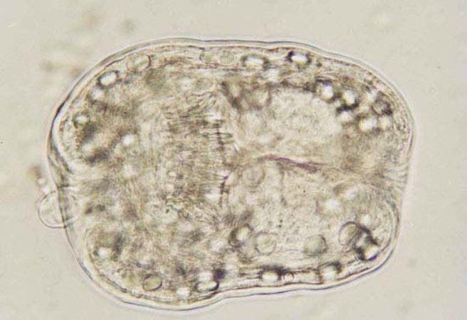 21Eg.protoscolex